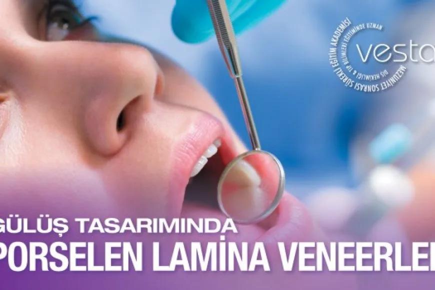 Gülüş Tasarımında Porselen Lamina Veneer Eğitimi