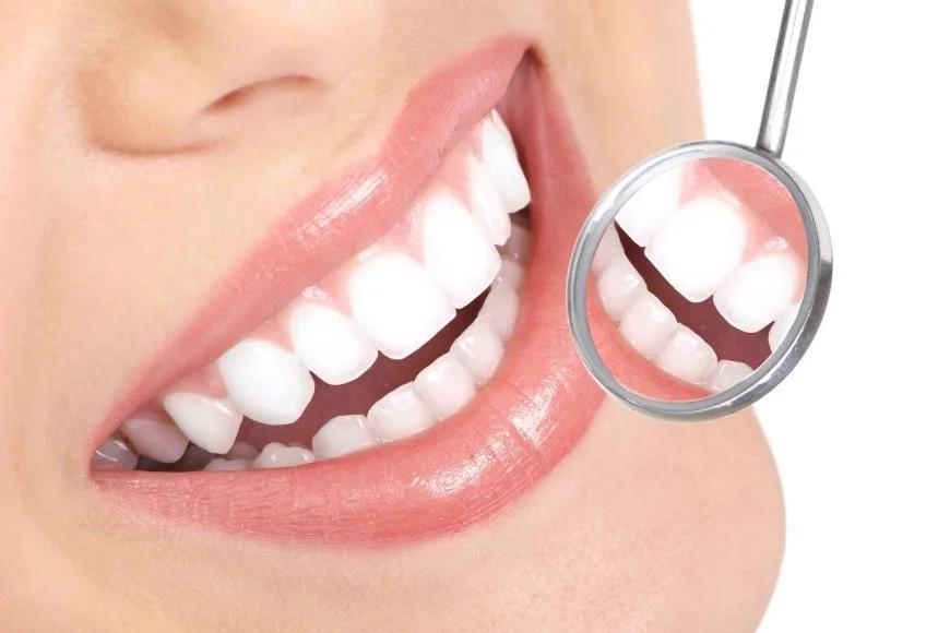 Anterior Estetik Kompozit Dolgular